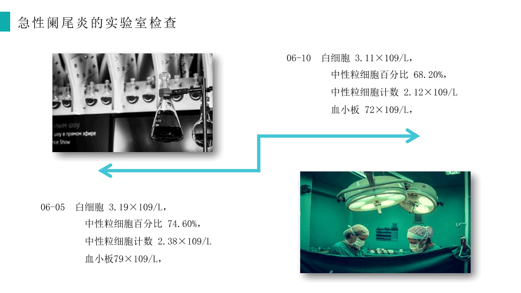 急性阑尾炎护理查房治疗PPT模板