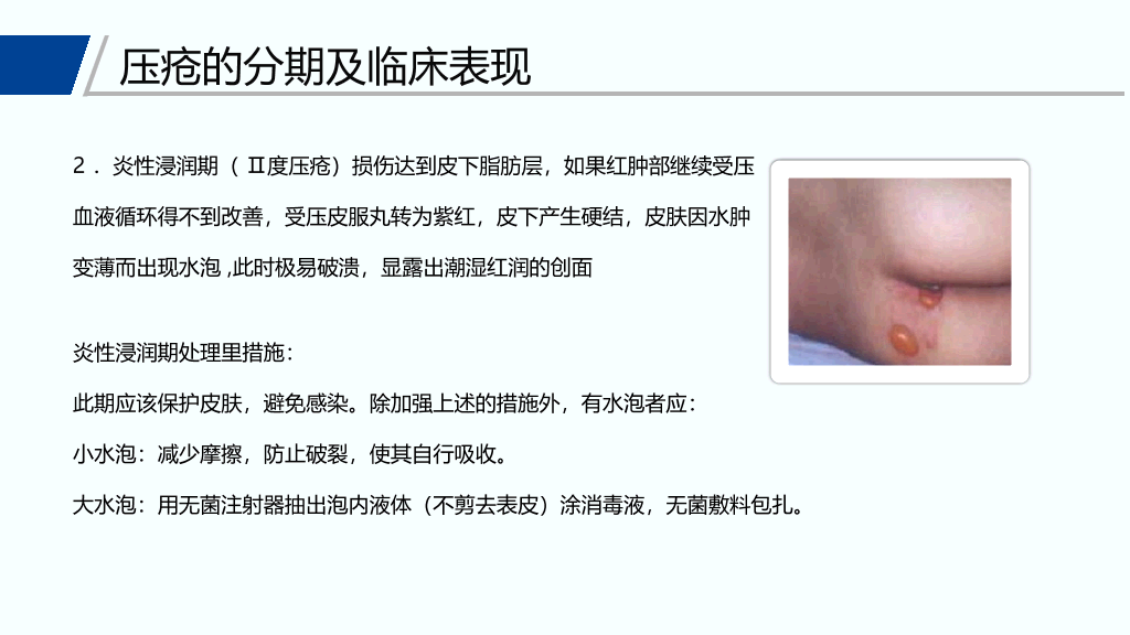 105#压疮预防和护理