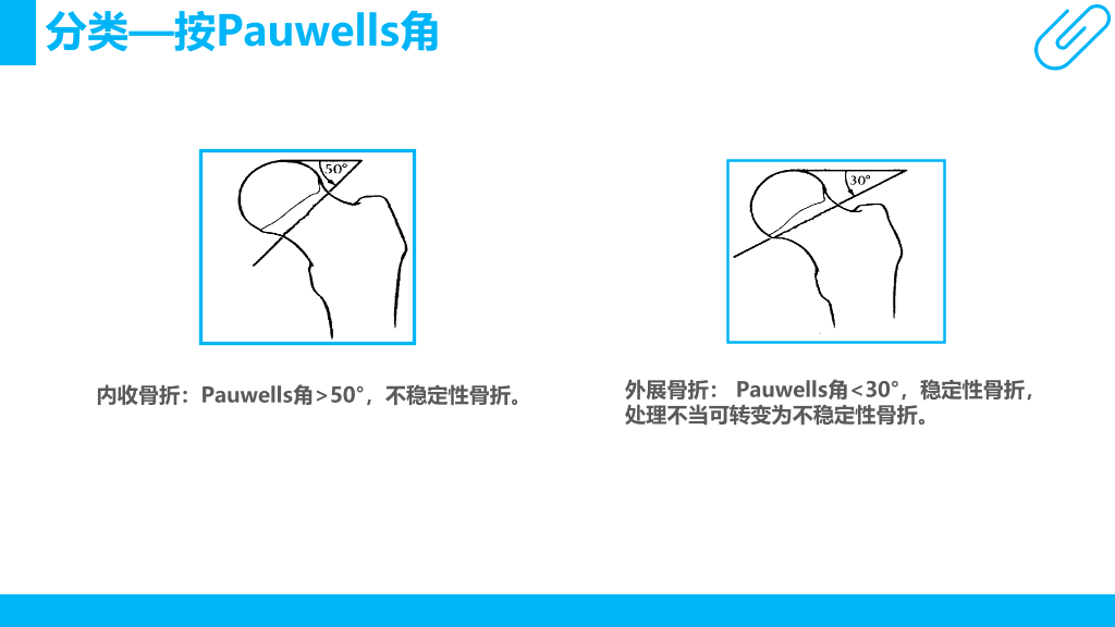 105#股骨颈骨折护理查房-2