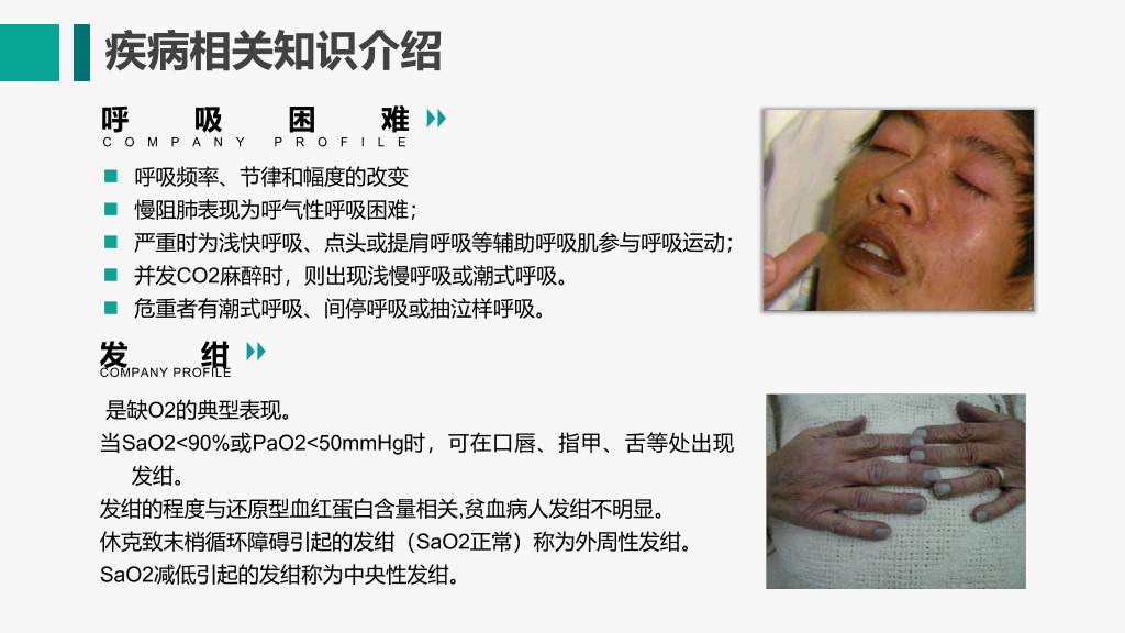 105#呼吸衰竭护理查房-3