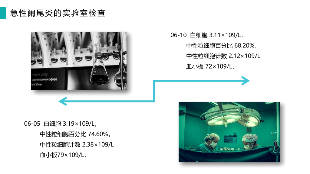 105#阑尾炎护理查房