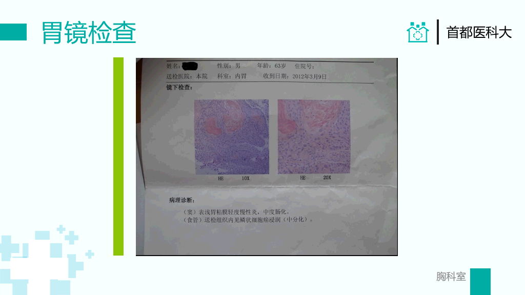 105#胸外科病例汇报