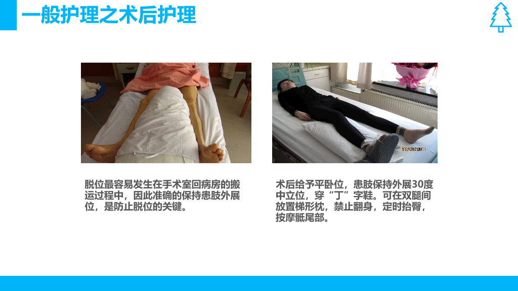 105#股骨颈骨折护理查房-2