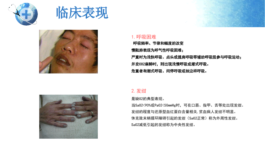 105#呼吸衰竭护理查房-2