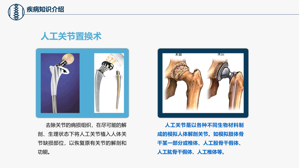 105#股骨颈骨折护理查房-3