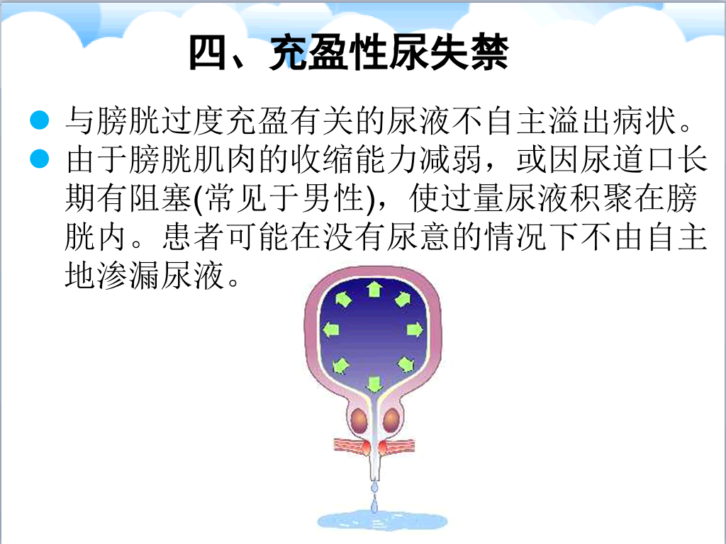 105#尿失禁评估与护理