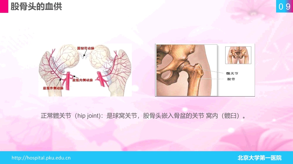 105#股骨颈骨折护理查房-1
