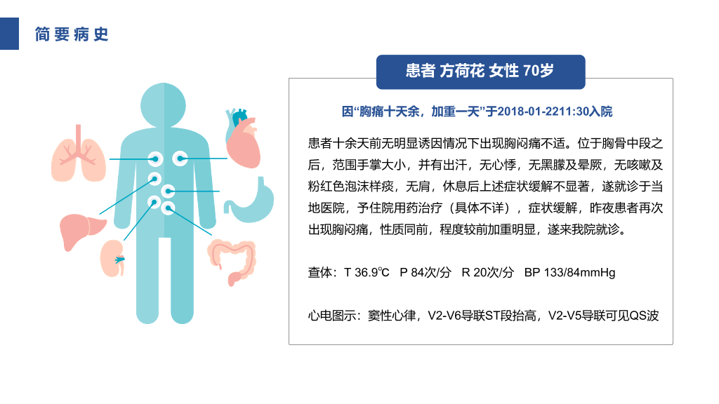 105#急性心机梗护理查房-1