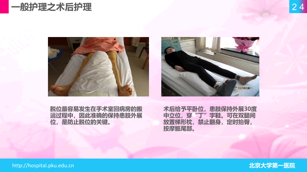 105#股骨颈骨折护理查房-1