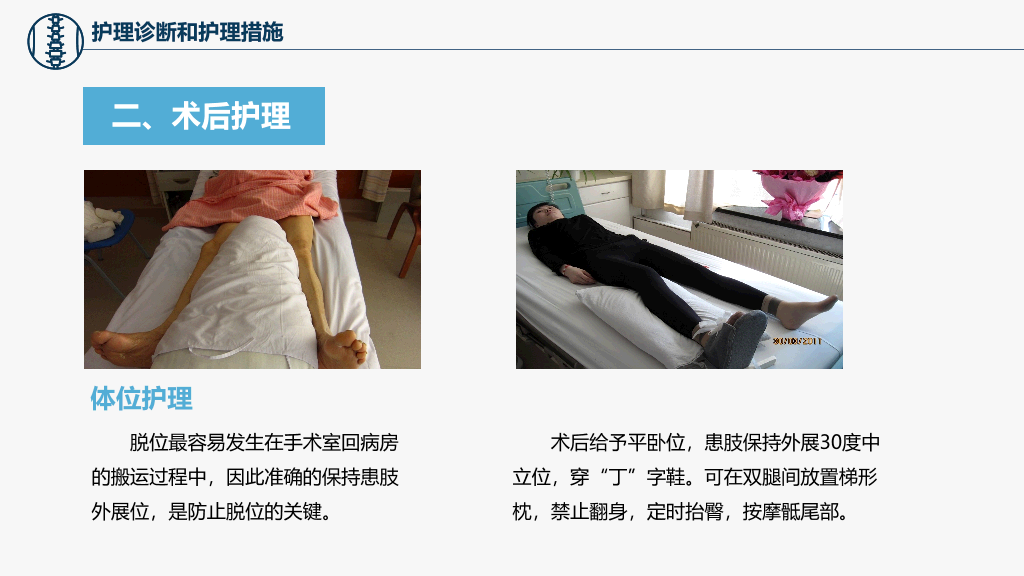 105#股骨颈骨折护理查房-3