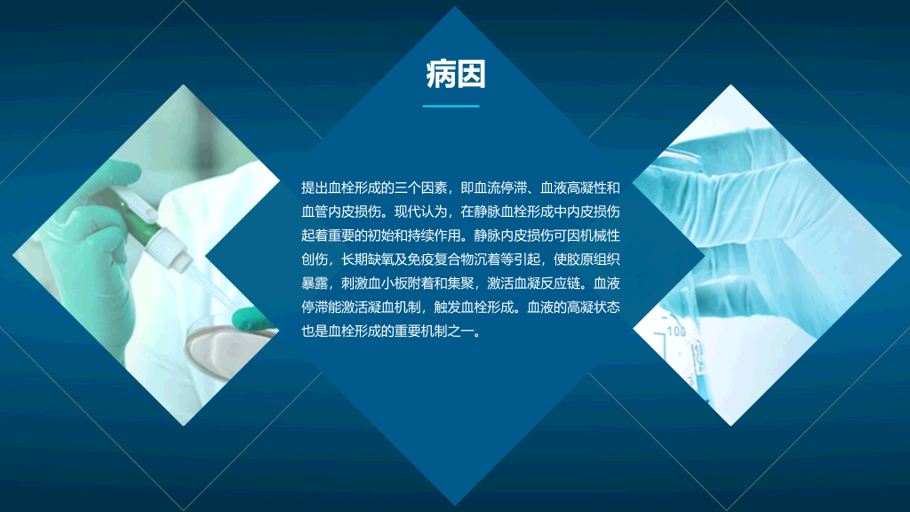 105#肺栓塞病人护理查房-1