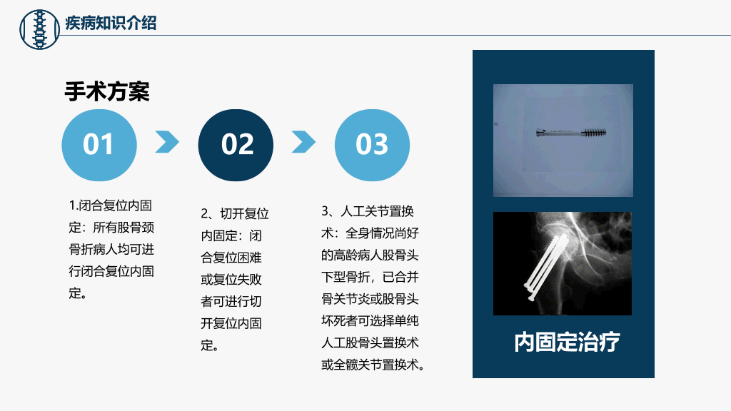 105#股骨颈骨折护理查房-3